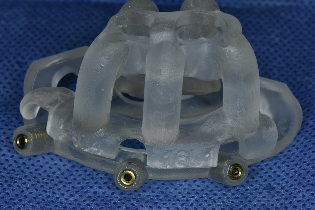 Guía quirúrgica para colocación de implantes